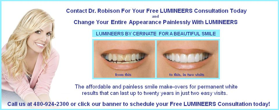 Porclain Veneers in Mesa AZ