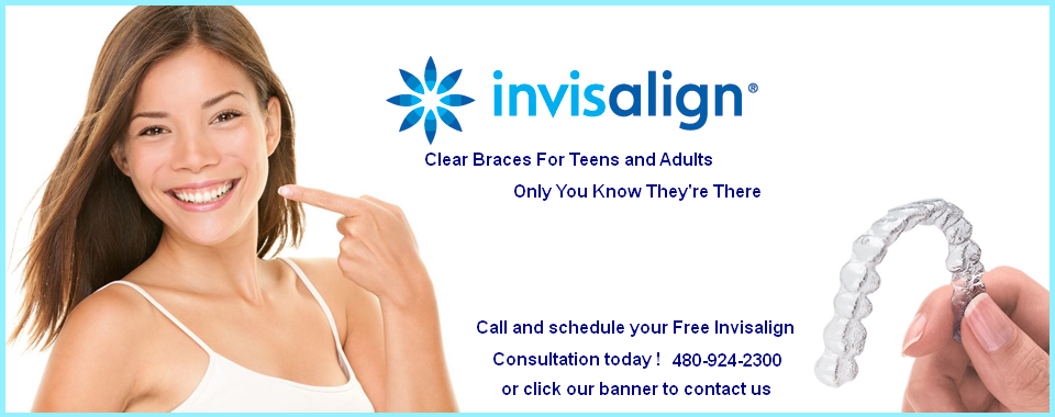 invisalign braces in mesa az