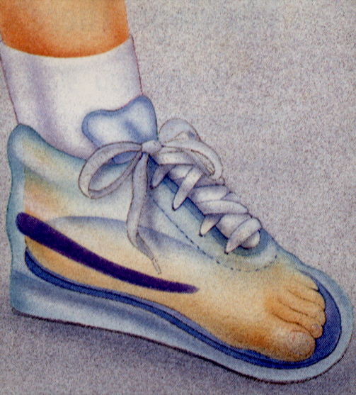 Image description